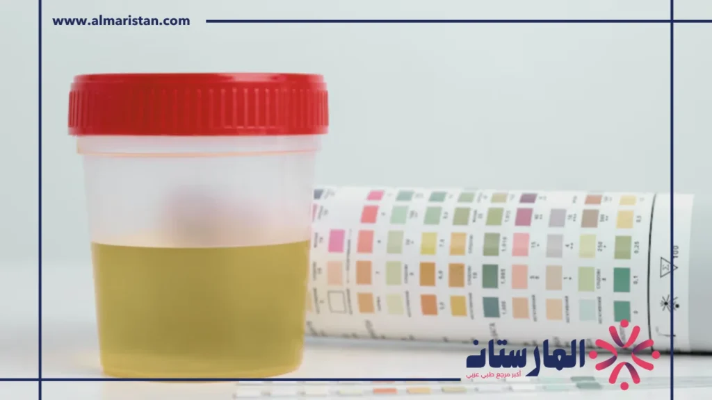 تحليل alkaline phosphatase