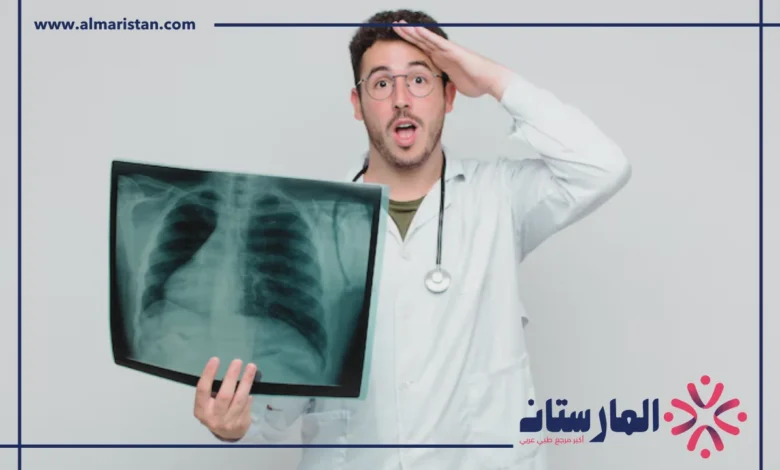 أسباب الماء في الرئة