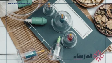 أنواع الحجامة