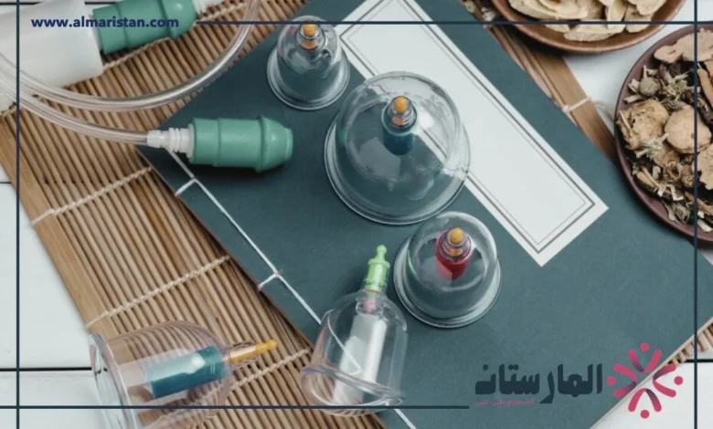 أنواع الحجامة