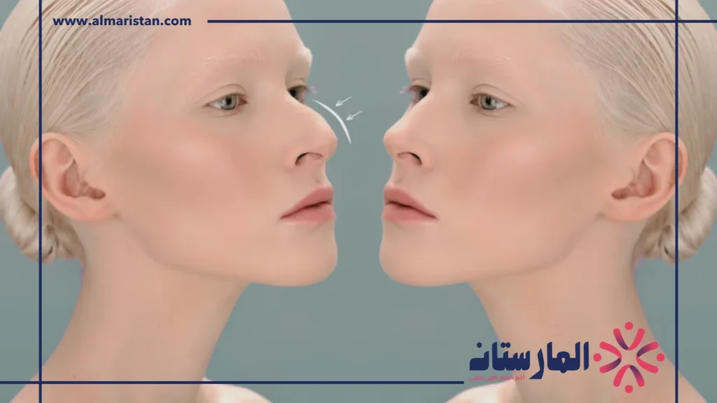 أنواع عمليات تجميل الأنف