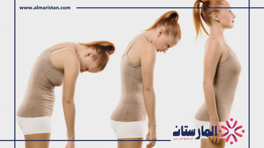 استقامة الظهر