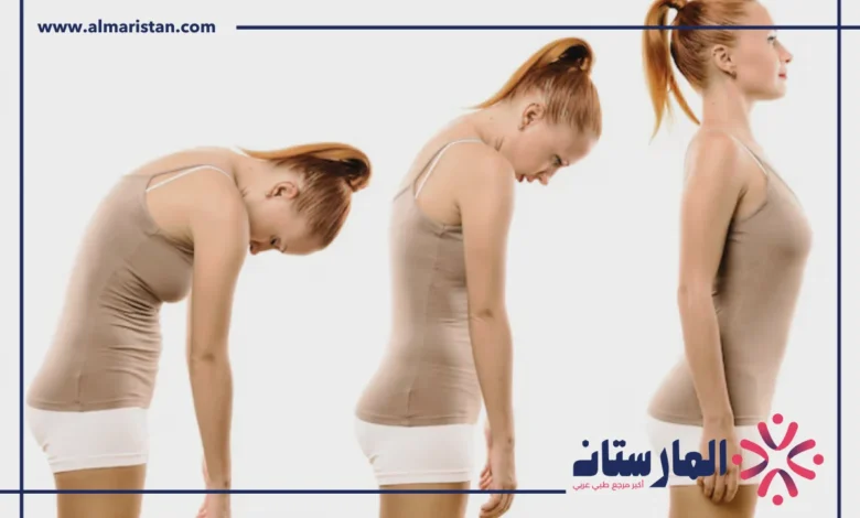 استقامة الظهر