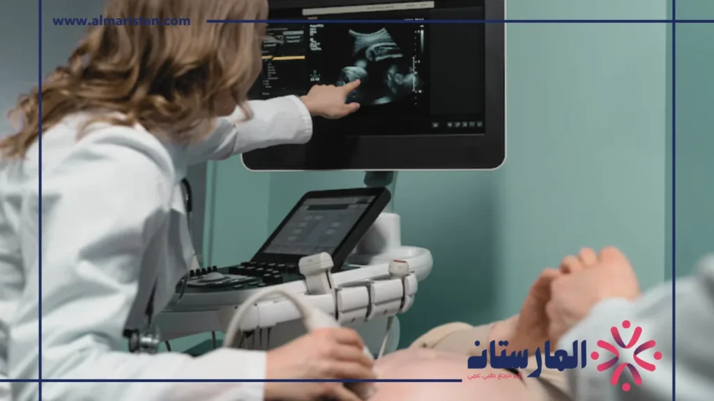 الاشعة الصوتية