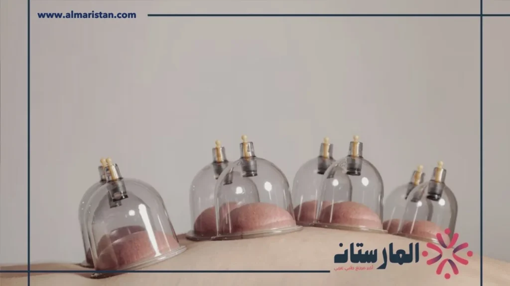 التدخين بعد الحجامة (2) التدخين بعد الحجامة