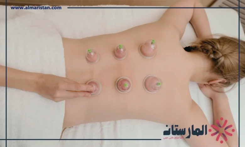 الحجامة للنساء