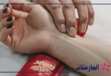 الحجامة والضغط