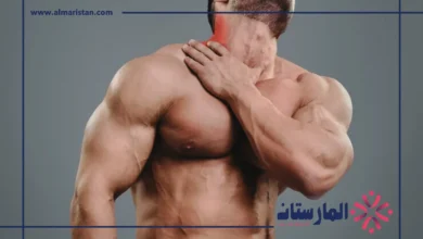 الوهن العضلي