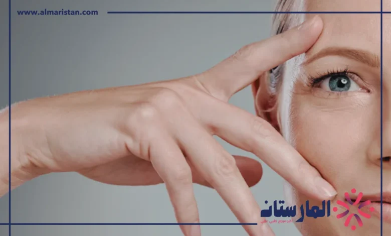 تجاعيد تحت العين