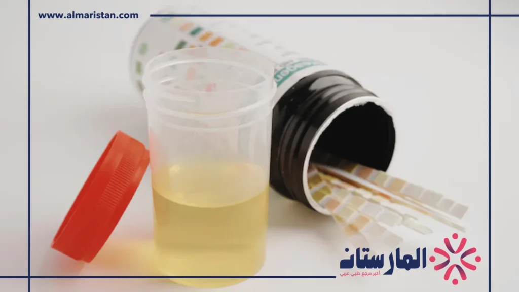 تحليل alkaline phosphatase