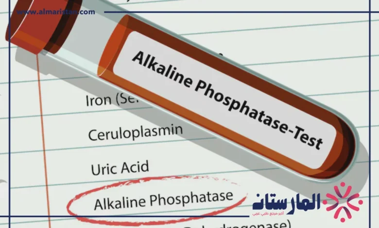 تحليل alkaline phosphatase
