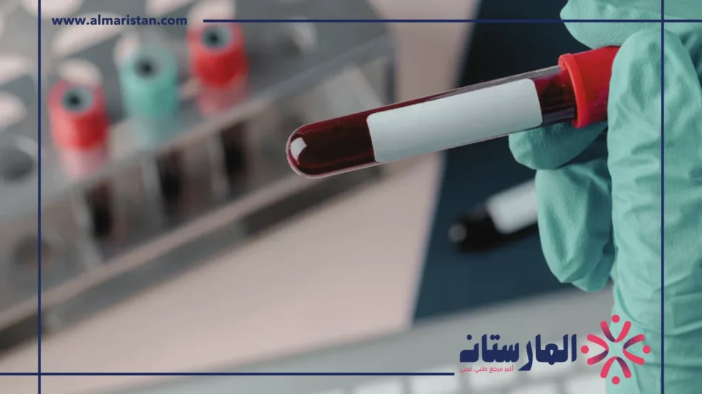 تحليل الدم الشامل