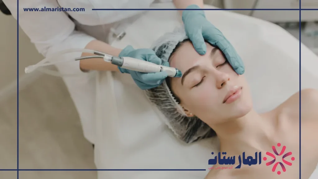 تنظيف الهيدرافيشل