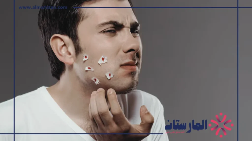 علاج البشرة الدهنية للرجال