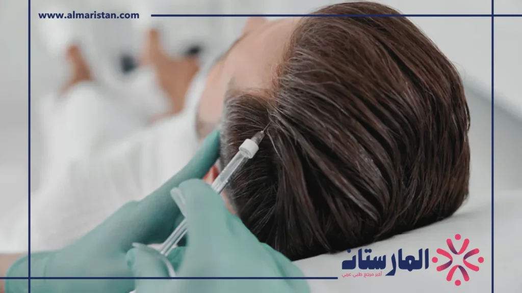 معالج الفيلر للشعر