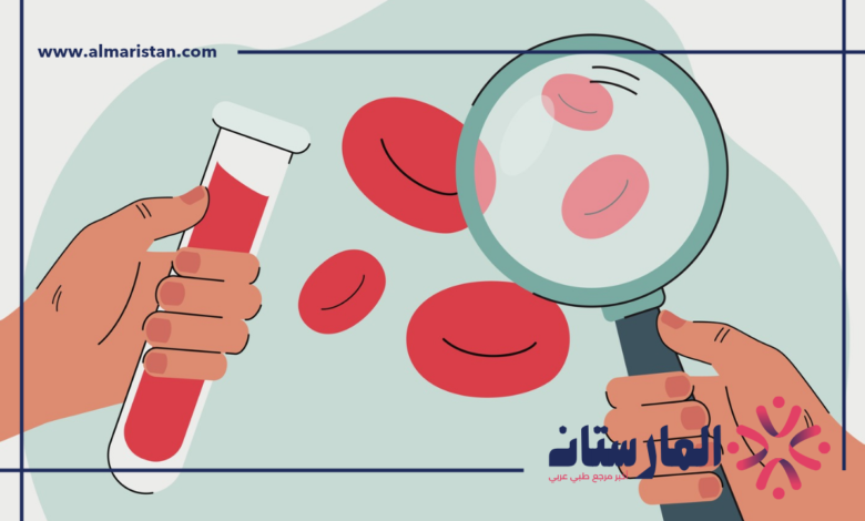 نقص كريات الدم البيضاء
