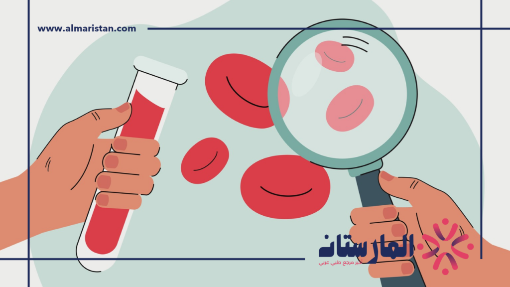 نقص كريات الدم البيضاء
