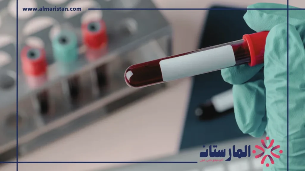 erythrocyte sedimentation rate تحليل