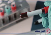 erythrocyte sedimentation rate تحليل
