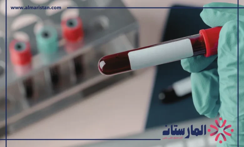 erythrocyte sedimentation rate تحليل