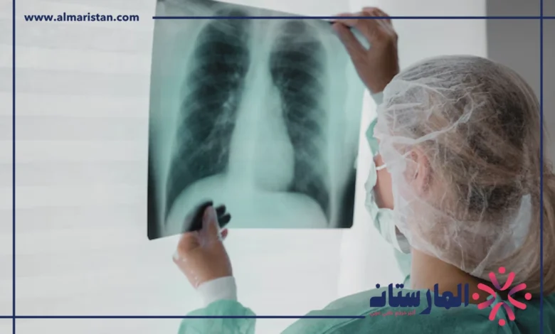 اشعة ايكو
