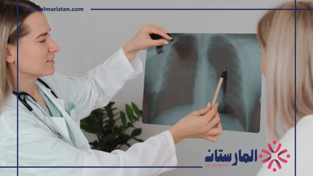 اشعة ايكو