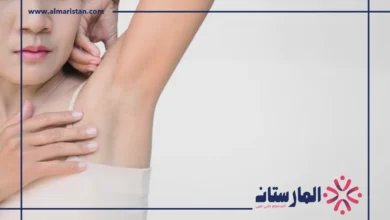 الحكة بعد الليزر