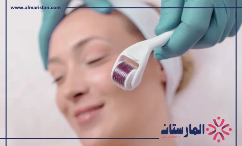 الديرما رولر
