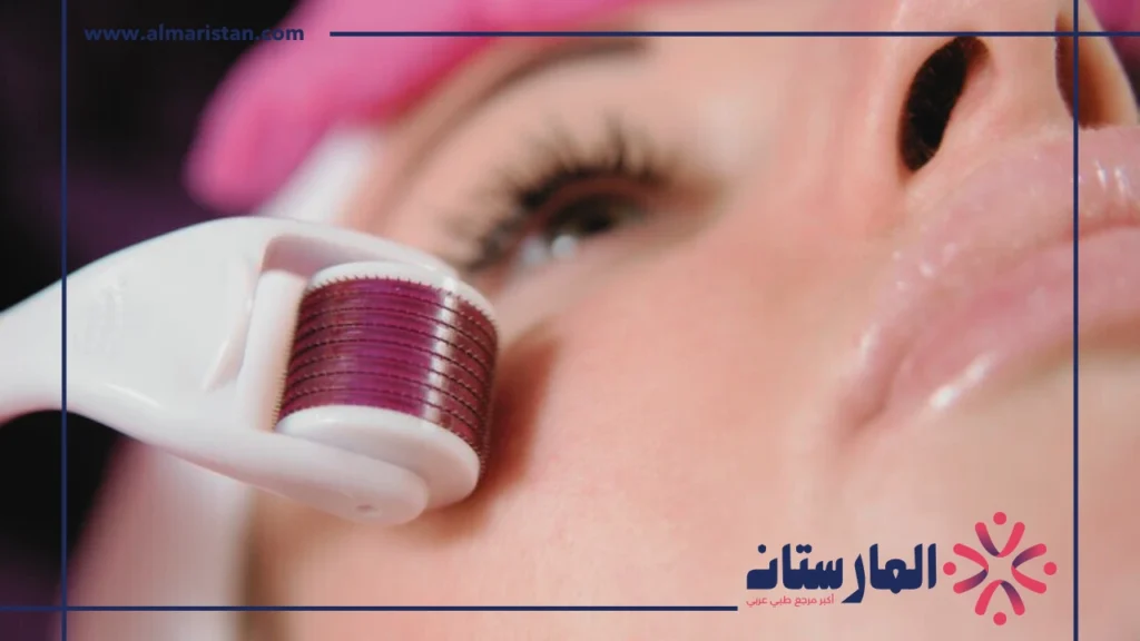 الديرما رولر