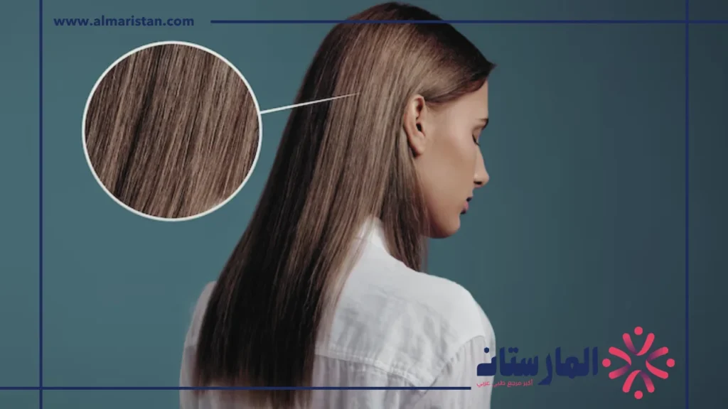 القشرة تسبب تساقط الشعر