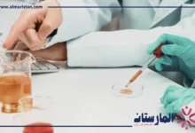 تحليل ALT