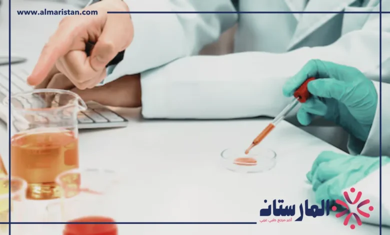تحليل ALT
