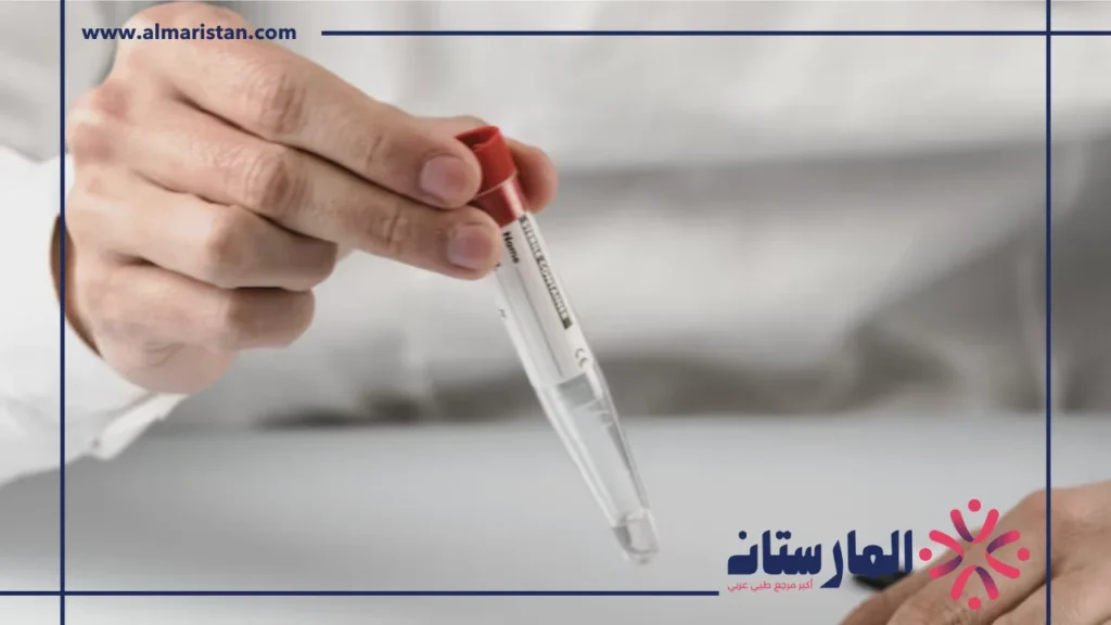 تحليل ALT