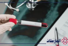 تحليل HCT