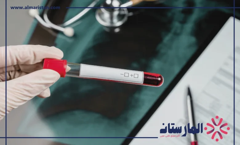 تحليل HCT