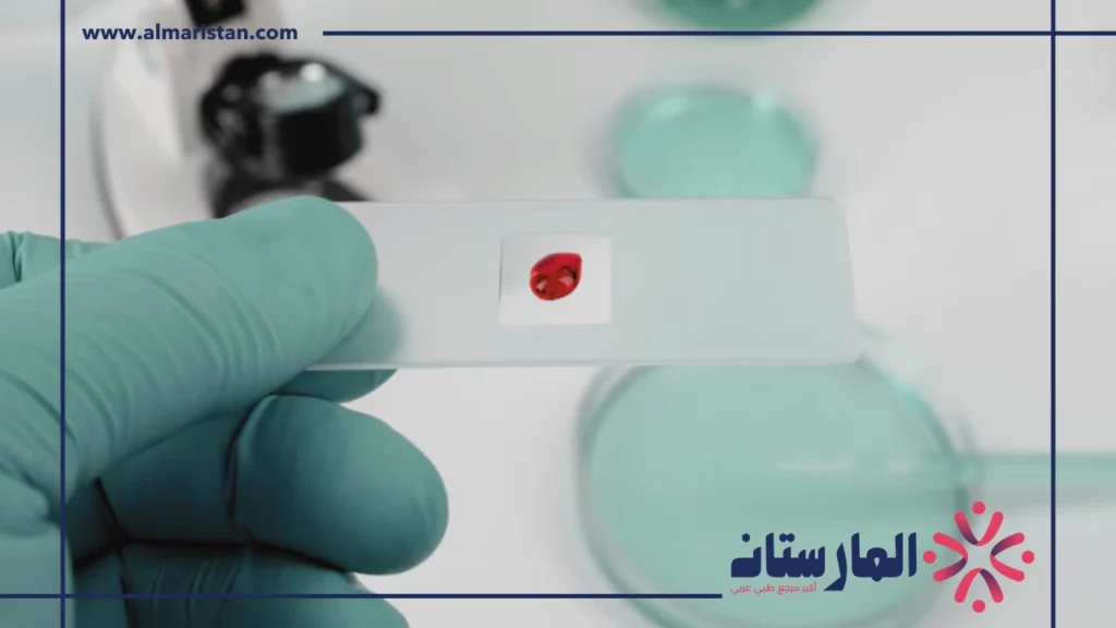 تحليل Monocytes