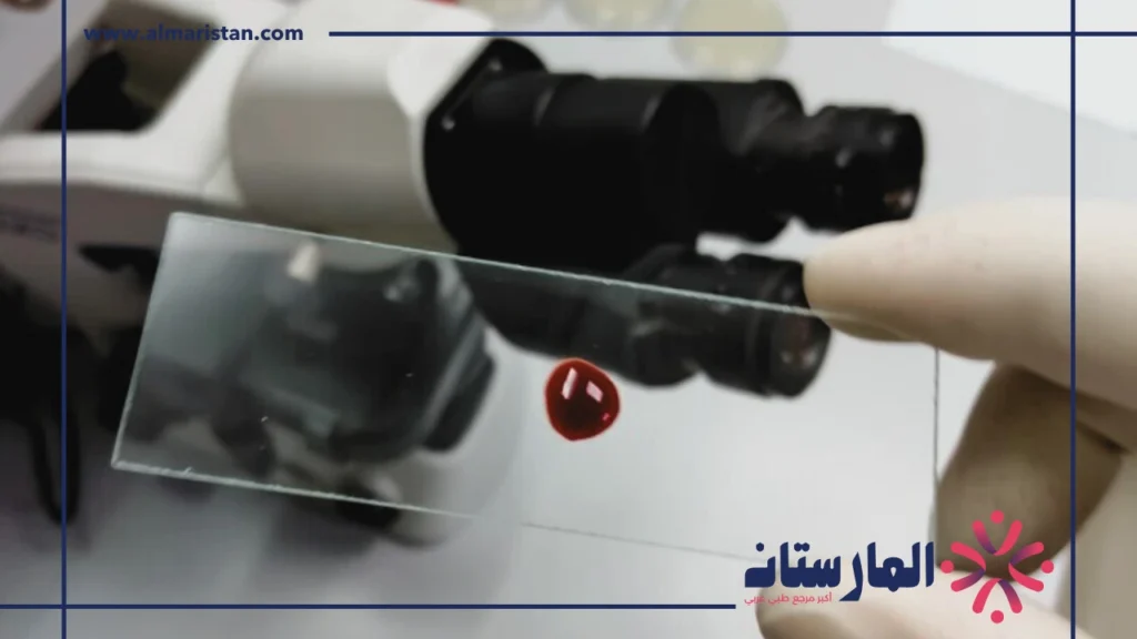 تحليل Monocytes