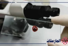 تحليل Monocytes