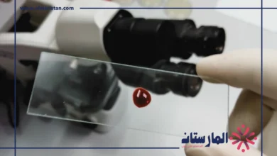 تحليل Monocytes