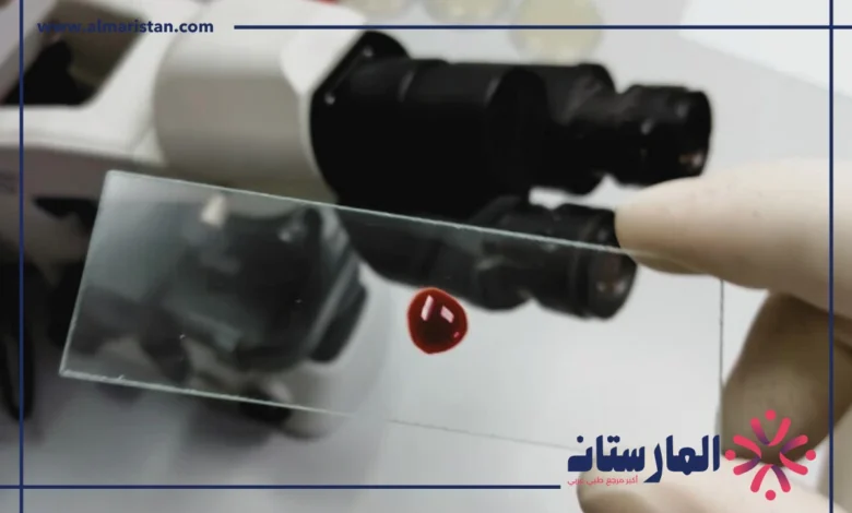 تحليل Monocytes