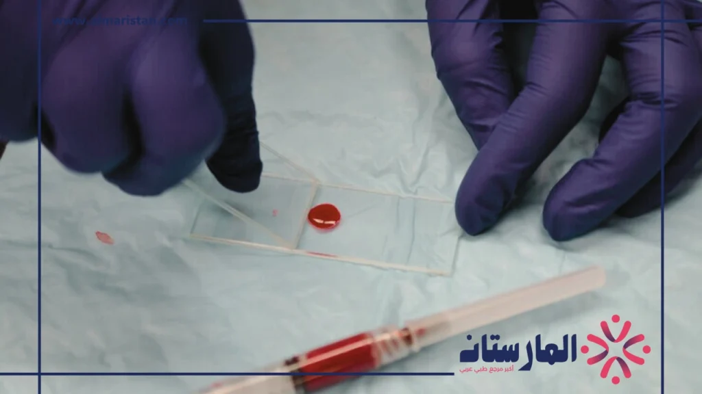 تحليل Monocytes