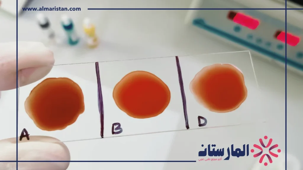 تحليل Monocytes