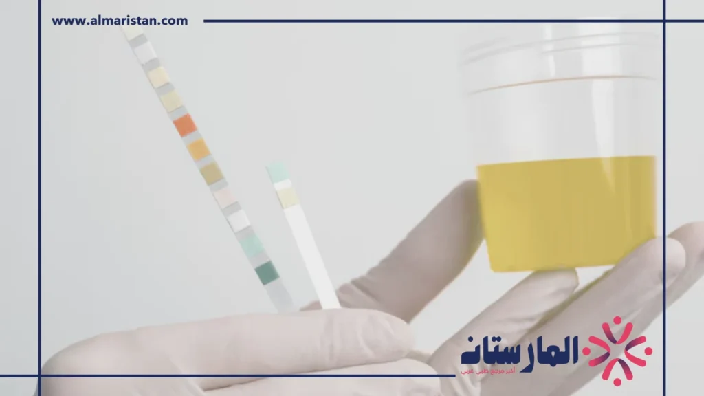 تحليل البول