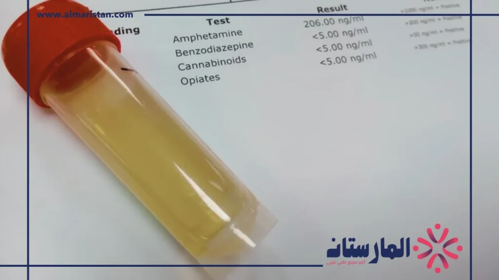 تحليل البول
