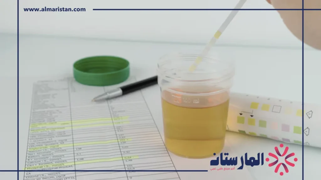تحليل البول
