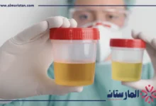 تحليل البول