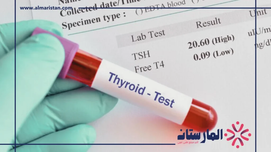 تحليل الغدة الدرقية