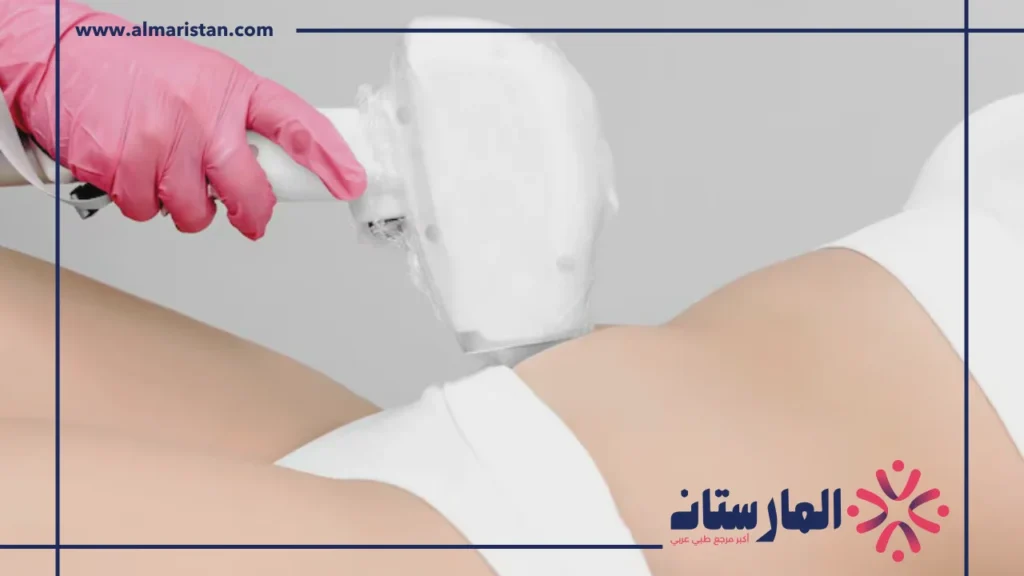 تفتيح المناطق الحساسة بالليزر