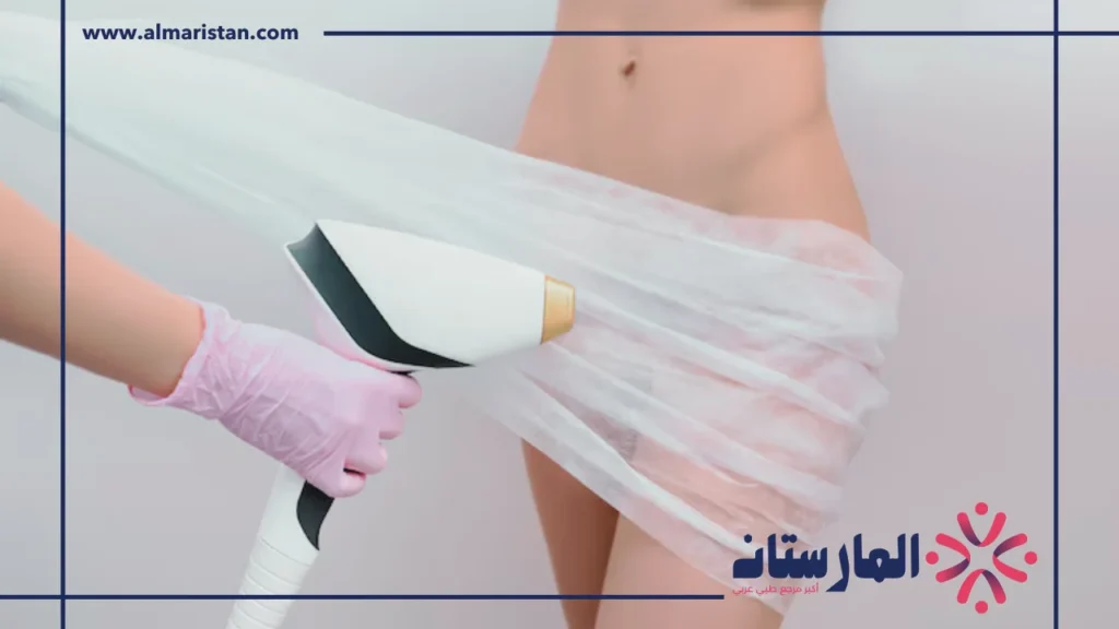 تفتيح المناطق الحساسة بالليزر