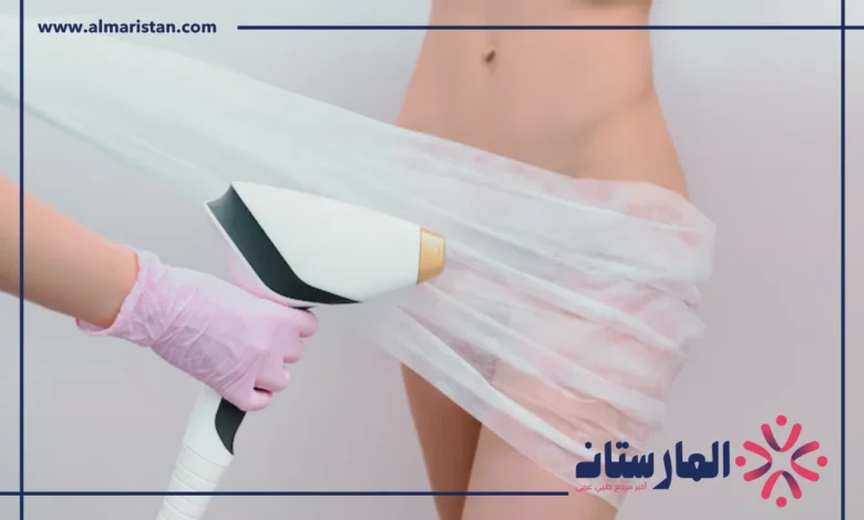 تفتيح المناطق الحساسة بالليزر